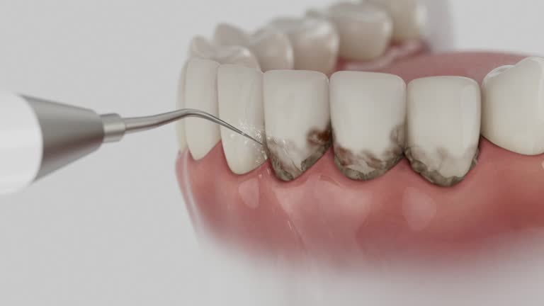 Trusted Dental Implants service in Dulles Town Center, VA - Dentist Open Now